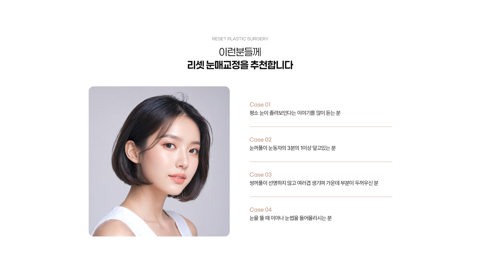눈매교정 03