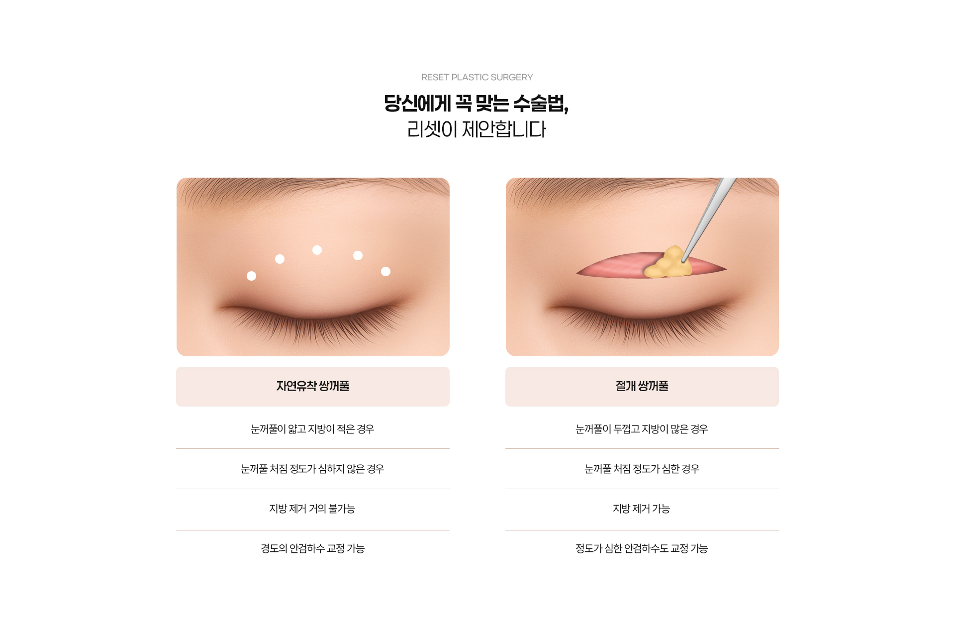 쌍꺼풀 05