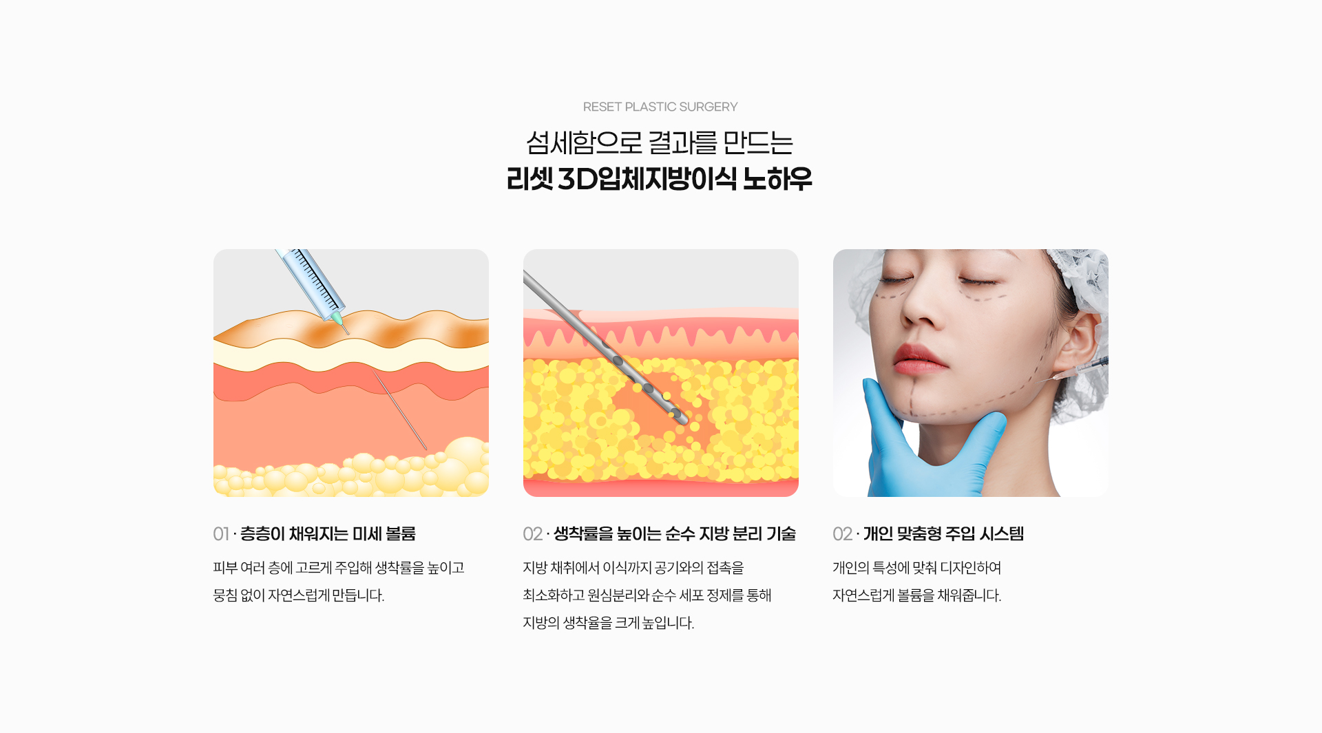 3D입체지방이식 04