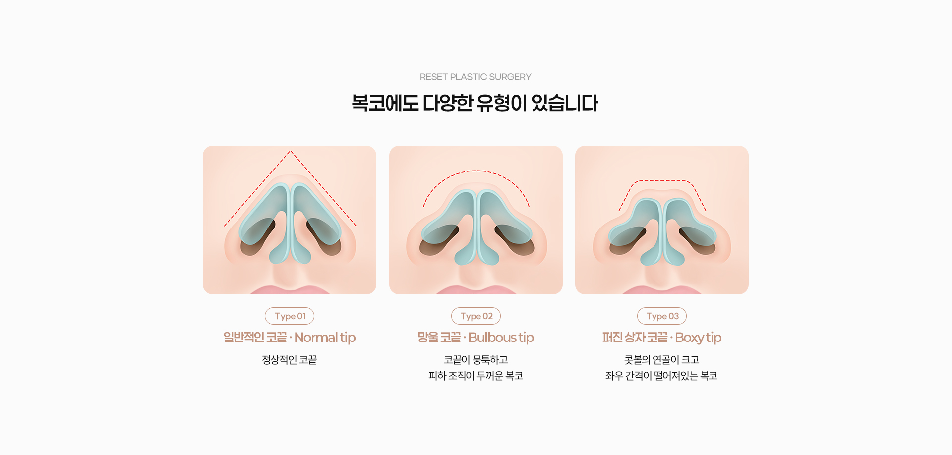 복코 04