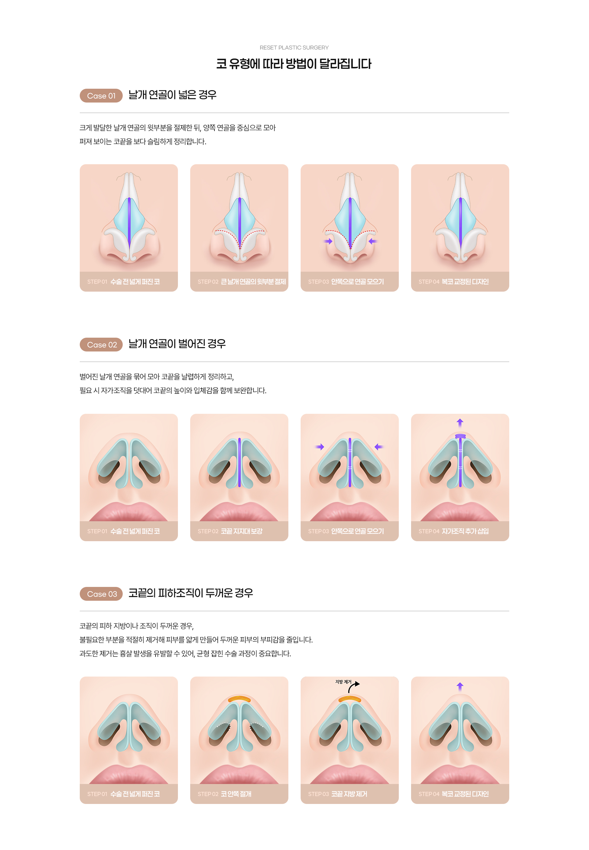 복코 05