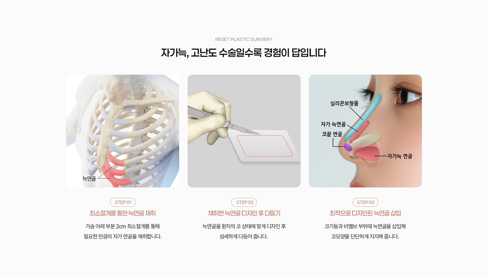 자가늑 04