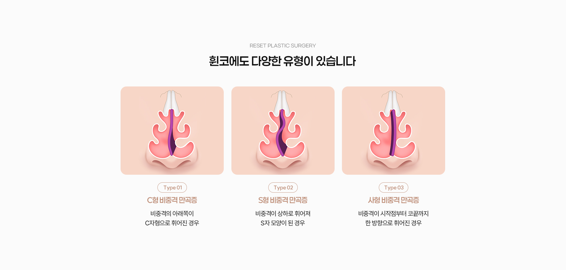 휜코 04
