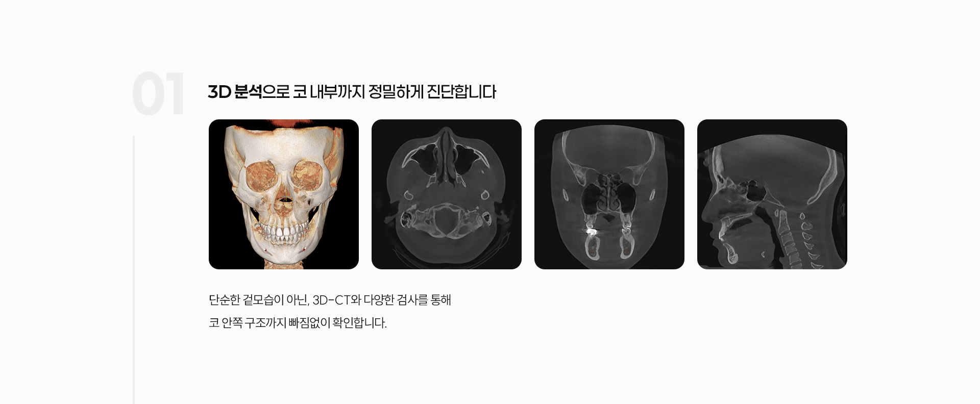 기능코성형 06
