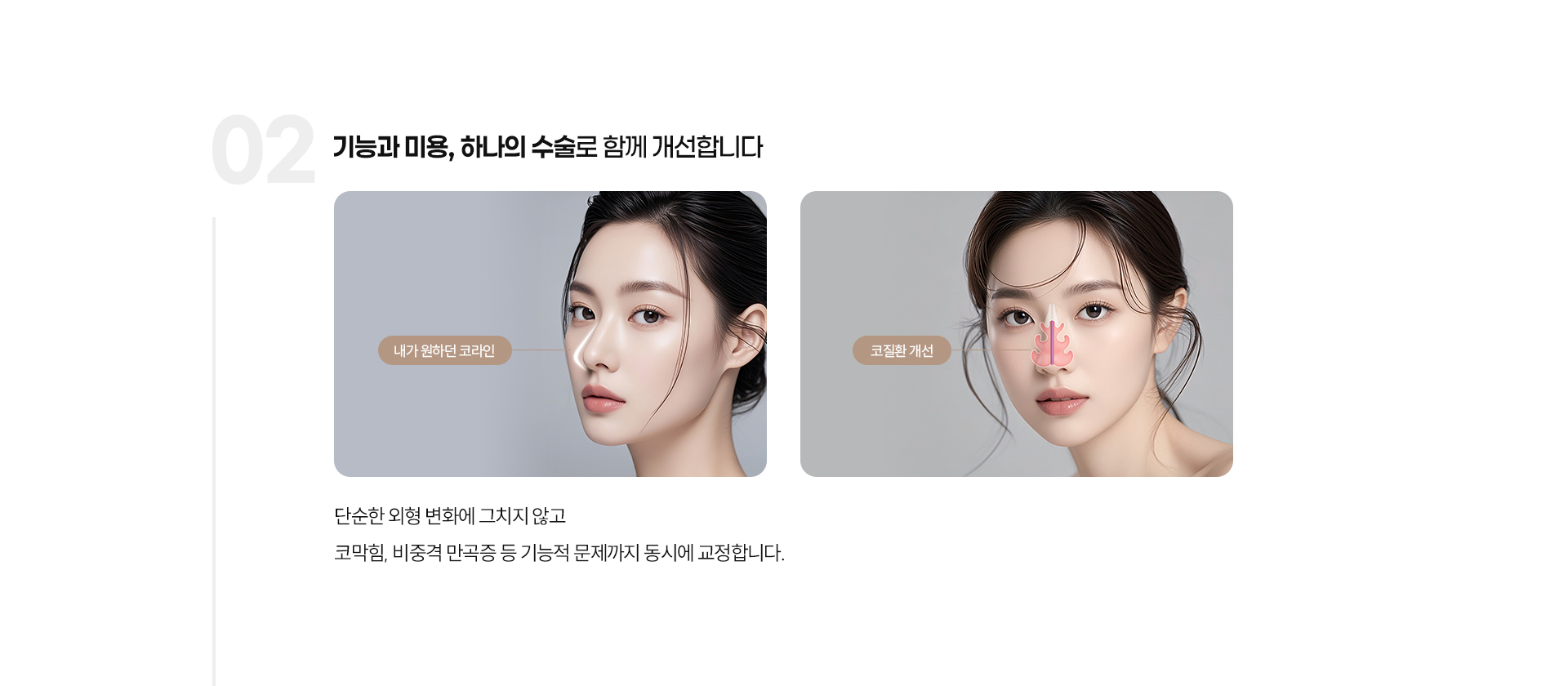 기능코성형 07