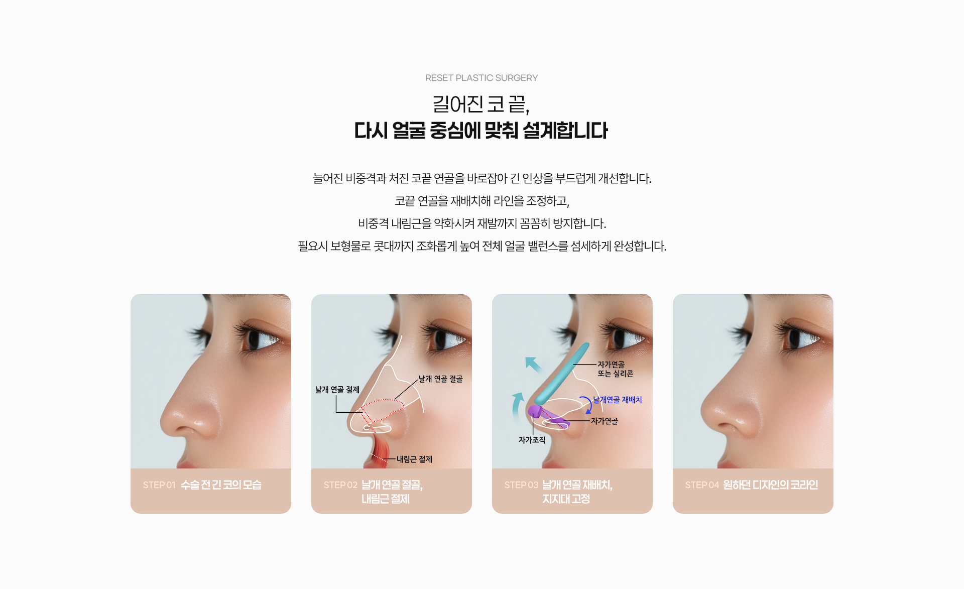 긴코 04