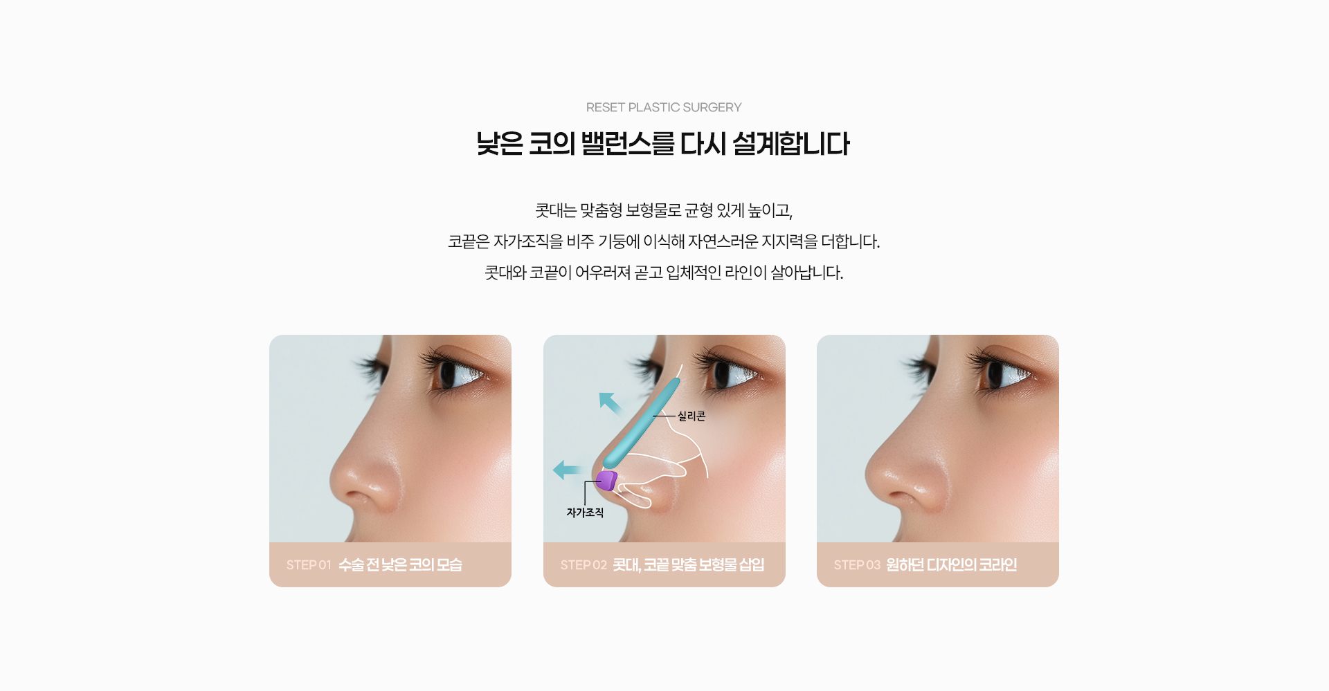 낮은코 04