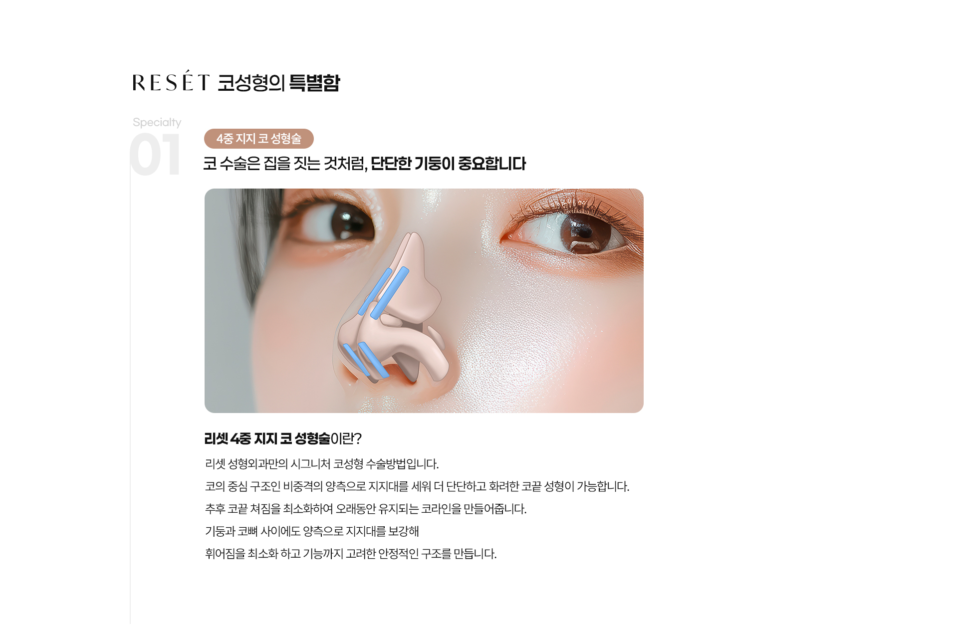 리셋코성형 03