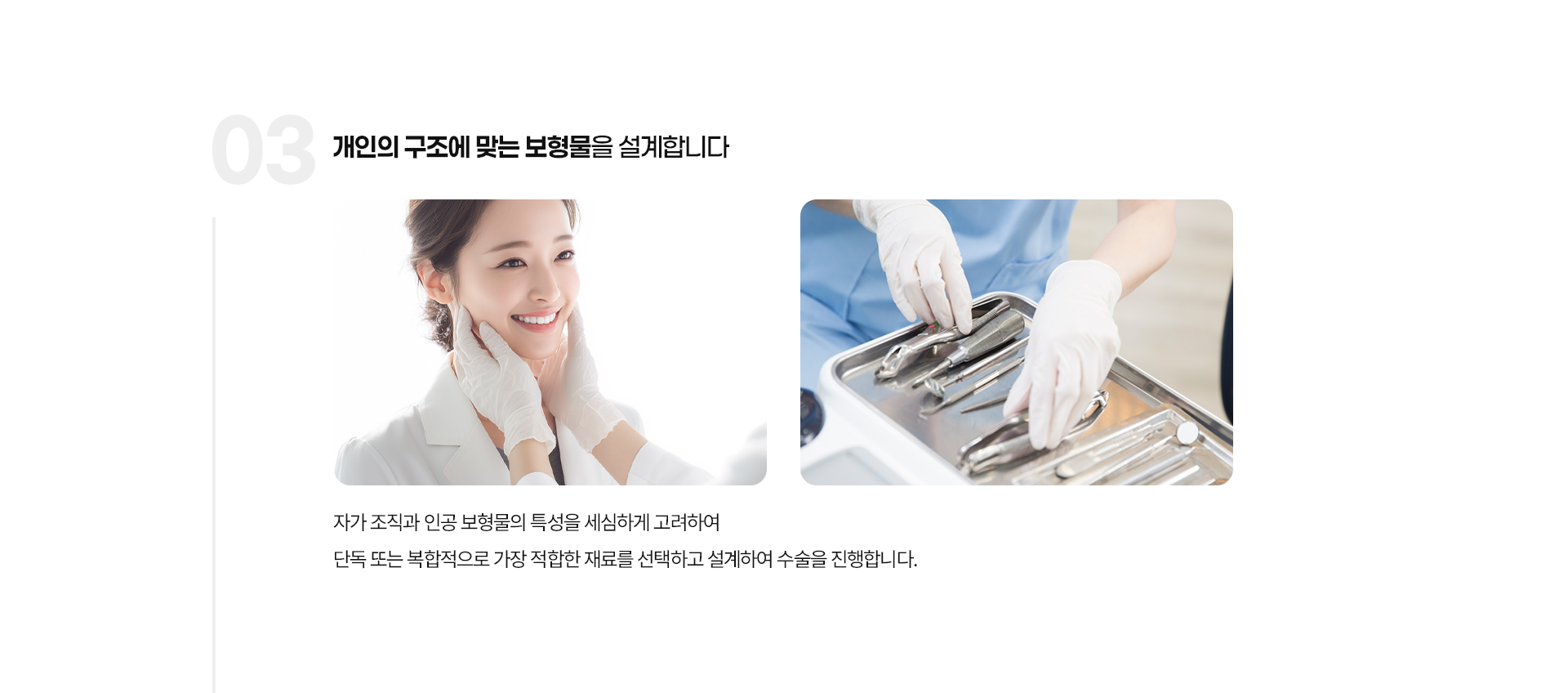 입체볼륨 코성형 05
