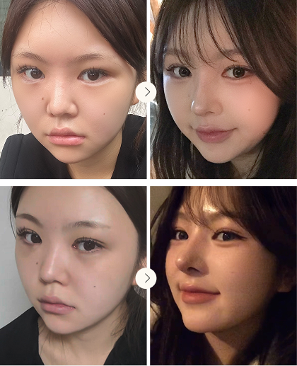 비주 라인 개선