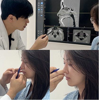 1:1 개인 맞춤 수술 설계 시스템